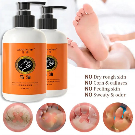 copy of copy of copy of Krém na nohy - 150ml - 30%